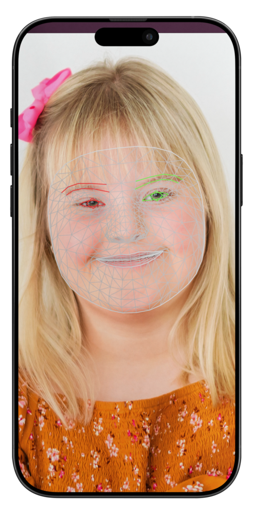 A phone displaying a child with down syndrome smiling at the camera with lines overlayed on the face.