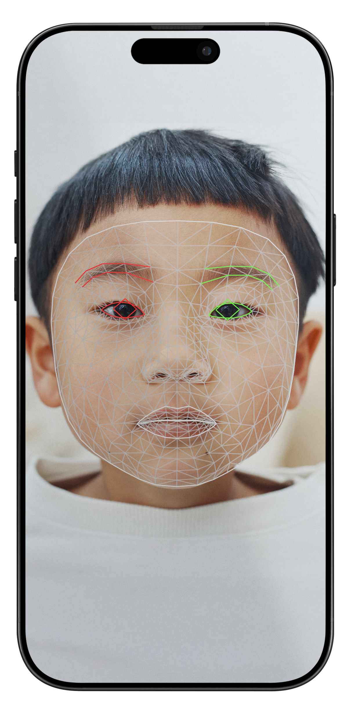 A phone displaying an Asian child with down syndrome smiling at the camera with lines overlayed on the face.