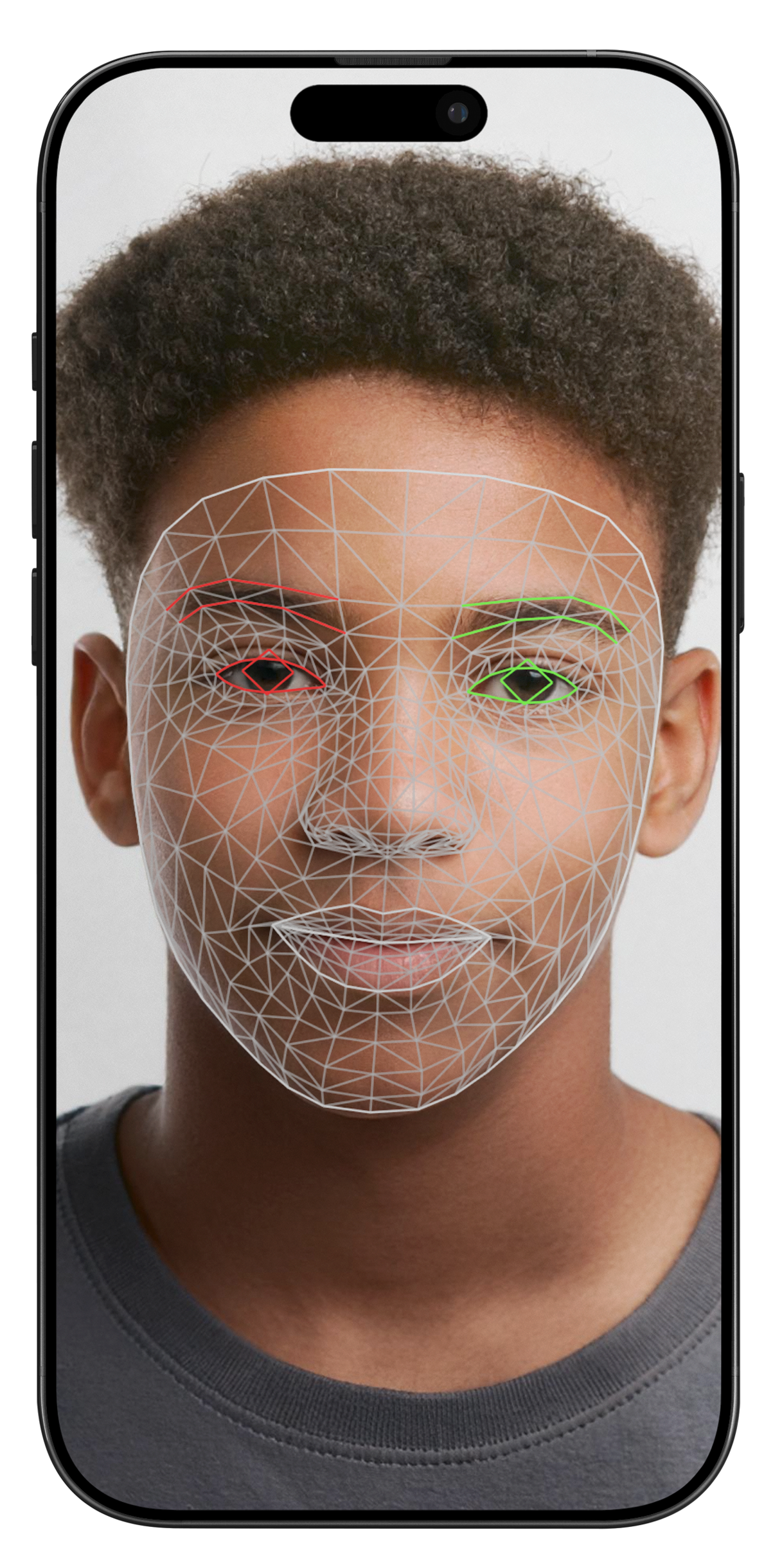 A phone displaying a Black child with down syndrome smiling at the camera with lines overlayed on the face.